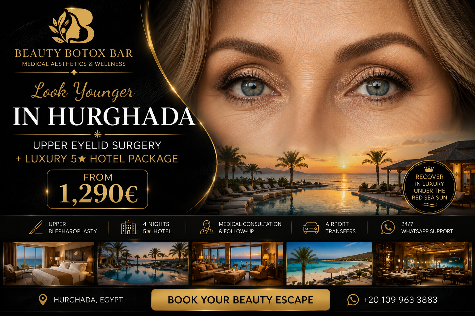Upper eyelid surgery and 5-star hotel package in Hurghada